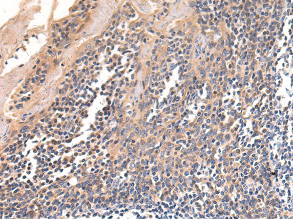 Anti-Telomerase Reverse Transcriptase Rabbit Polyclonal Antibody