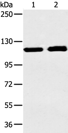 Anti-Telomerase Reverse Transcriptase Rabbit Polyclonal Antibody