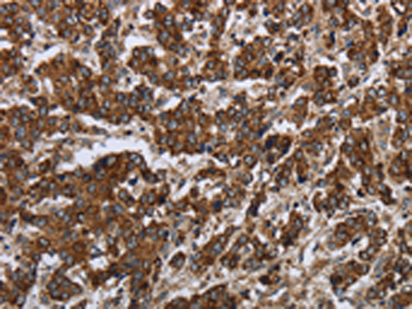 Anti-PPP1R13L Rabbit Polyclonal Antibody
