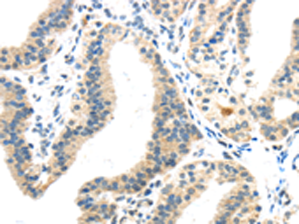 Anti-Inhibin beta B Rabbit Polyclonal Antibody