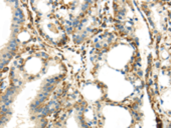 Anti-IQGAP2 Rabbit Polyclonal Antibody