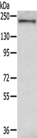 Anti-IQGAP2 Rabbit Polyclonal Antibody