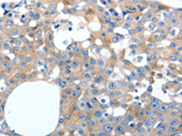 Anti-LILRB3 Rabbit Polyclonal Antibody
