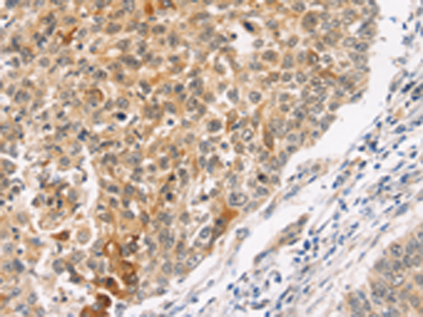 Anti-JNK2 Rabbit Polyclonal Antibody