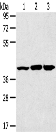Anti-JNK2 Rabbit Polyclonal Antibody