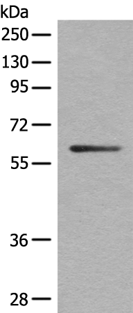 Anti-KCNC4 Rabbit Polyclonal Antibody