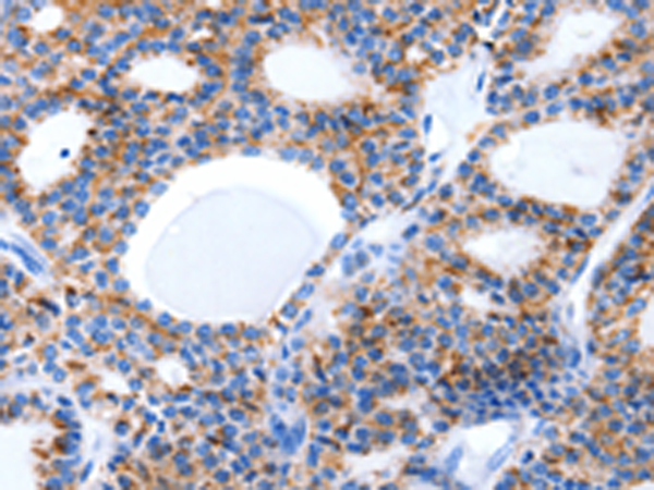 Anti-Laminin alpha 5 Rabbit Polyclonal Antibody