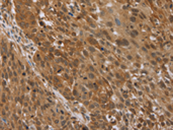 Anti-Stathmin 2/3/4 Rabbit Polyclonal Antibody