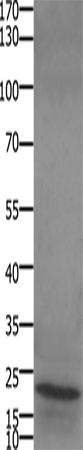 Anti-Stathmin 2/3/4 Rabbit Polyclonal Antibody