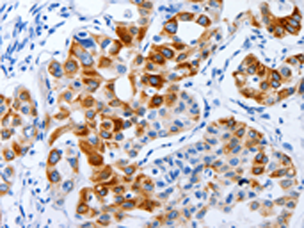 Anti-BPIFB3 Rabbit Polyclonal Antibody