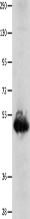 Anti-BPIFB3 Rabbit Polyclonal Antibody