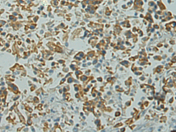Anti-MADCAM1 Rabbit Polyclonal Antibody
