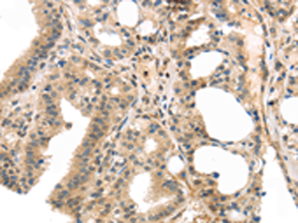 Anti-MASP2 Rabbit Polyclonal Antibody
