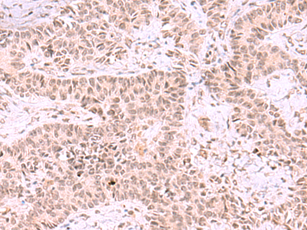 Anti-MCMBP Rabbit Polyclonal Antibody