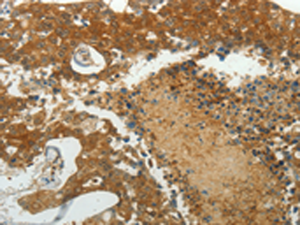 Anti-MCM4 Rabbit Polyclonal Antibody