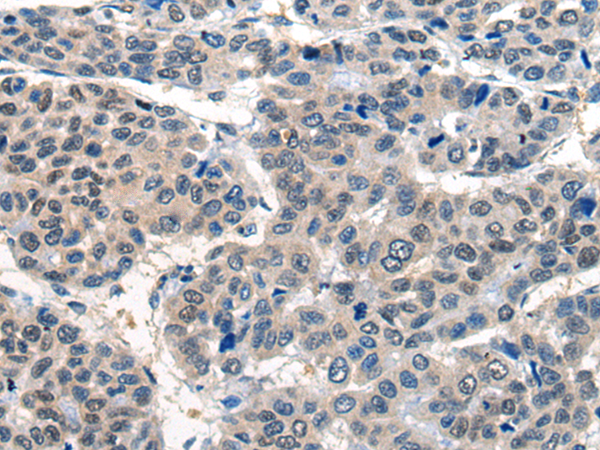 Anti-Bestrophin 1 Rabbit Polyclonal Antibody