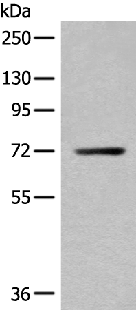 Anti-Bestrophin 1 Rabbit Polyclonal Antibody