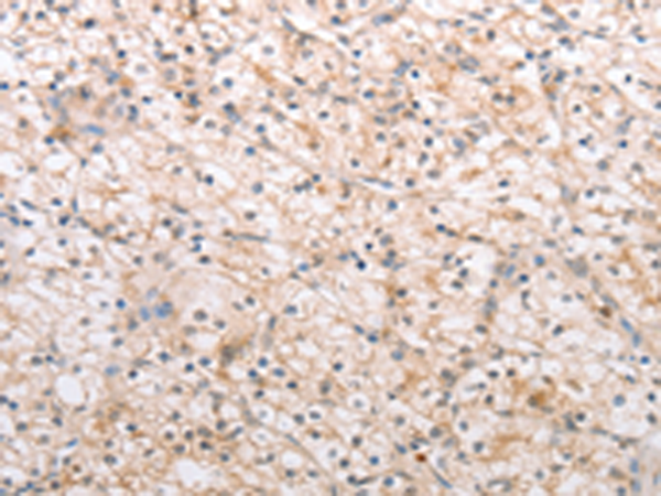 Anti-MMP11 Rabbit Polyclonal Antibody