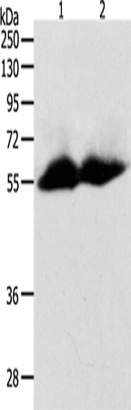 Anti-MMP11 Rabbit Polyclonal Antibody
