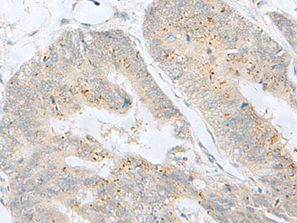 Anti-MLNR Rabbit Polyclonal Antibody