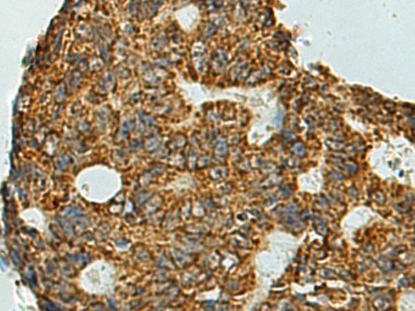 Anti-AChR alpha1 Rabbit Polyclonal Antibody