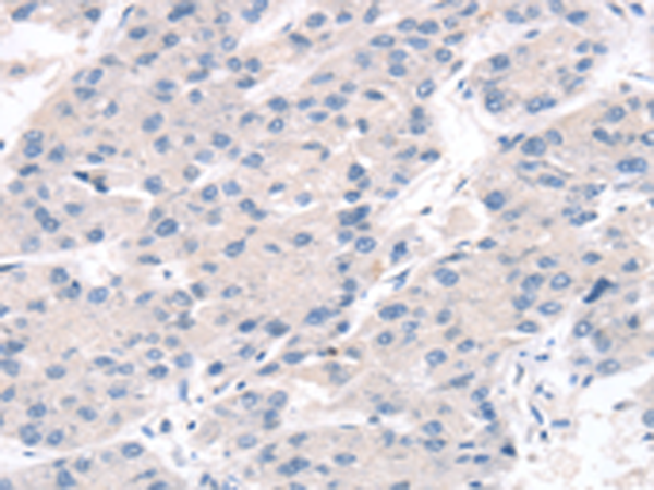 Anti-CHRNA3 Rabbit Polyclonal Antibody