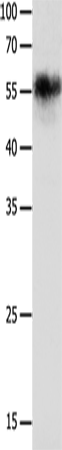 Anti-CHRNA3 Rabbit Polyclonal Antibody