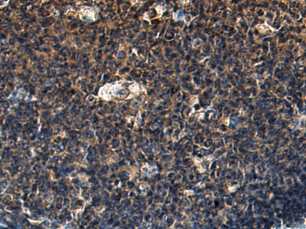 Anti-NCK2 Rabbit Polyclonal Antibody