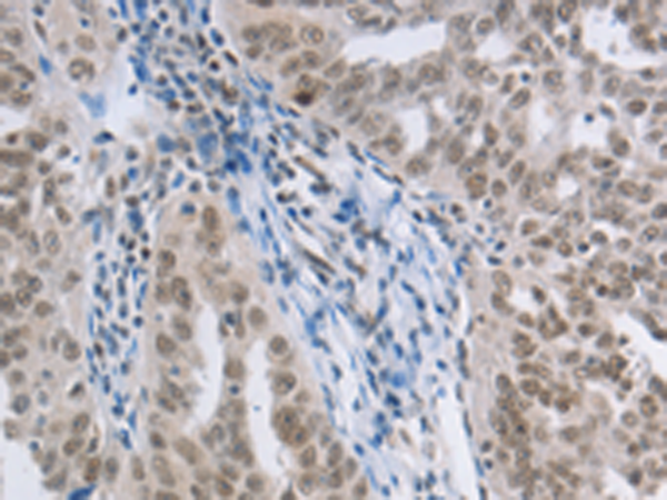Anti-AKAP95 Rabbit Polyclonal Antibody