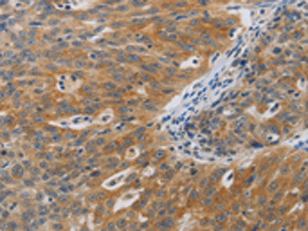 Anti-F2R Rabbit Polyclonal Antibody