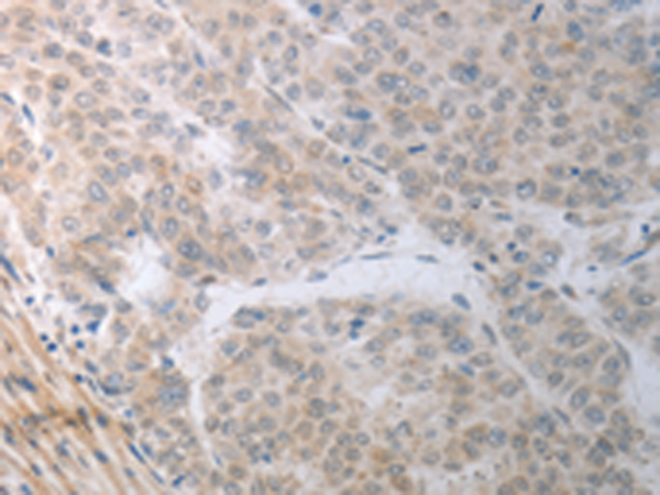 Anti-RBMS3 Rabbit Polyclonal Antibody