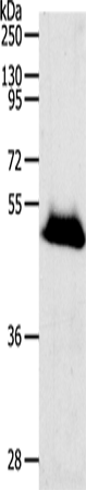 Anti-RBMS3 Rabbit Polyclonal Antibody