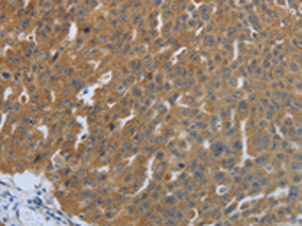 Anti-Sex Hormone Binding Globulin Rabbit Polyclonal Antibody