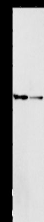 Anti-ACP2 Rabbit Polyclonal Antibody