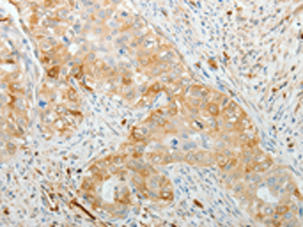 Anti-ADM Rabbit Polyclonal Antibody