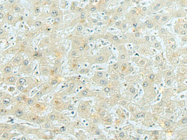 Anti-LPCAT4 Rabbit Polyclonal Antibody