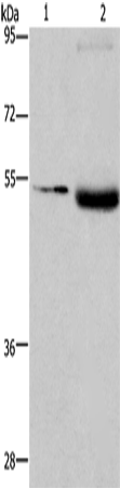 Anti-LPCAT4 Rabbit Polyclonal Antibody