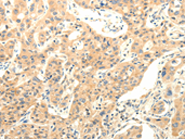 Anti-Agrin Rabbit Polyclonal Antibody