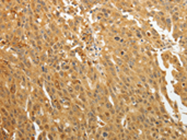 Anti-AKR1A1 Rabbit Polyclonal Antibody