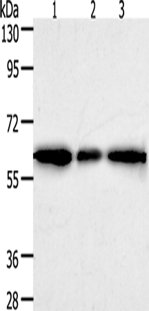 Anti-AKR1A1 Rabbit Polyclonal Antibody