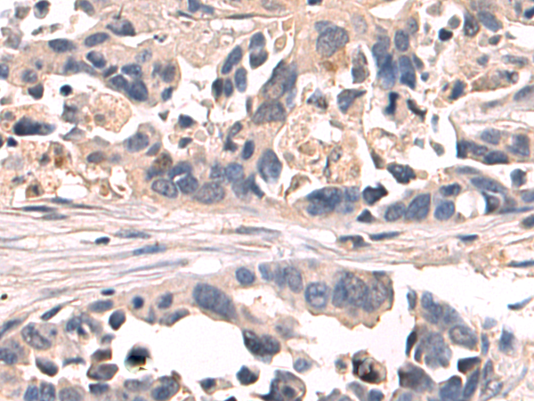 Anti-ANGPTL2 Rabbit Polyclonal Antibody