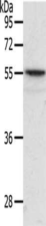 Anti-ANGPTL2 Rabbit Polyclonal Antibody