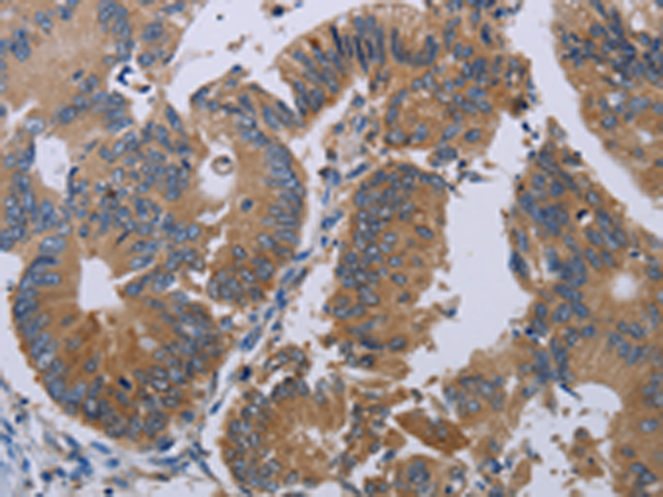 Anti-PKD3 Rabbit Polyclonal Antibody
