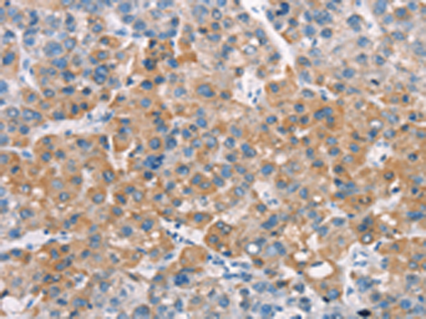 Anti-LATS2 Rabbit Polyclonal Antibody