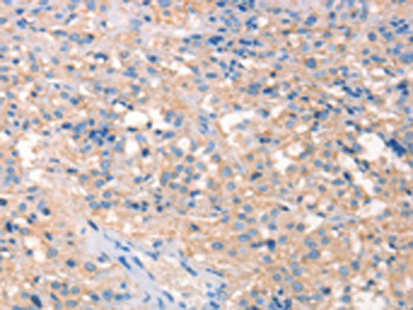 Anti-PRPS1 Rabbit Polyclonal Antibody
