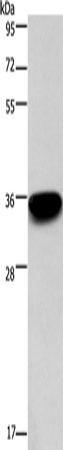 Anti-PRPS1 Rabbit Polyclonal Antibody