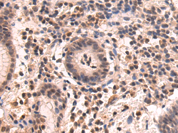 Anti-SGK2 Rabbit Polyclonal Antibody