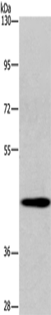 Anti-SGK2 Rabbit Polyclonal Antibody