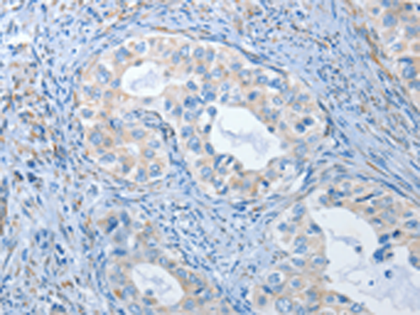 Anti-PKG2 Rabbit Polyclonal Antibody