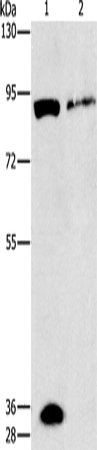 Anti-PKG2 Rabbit Polyclonal Antibody